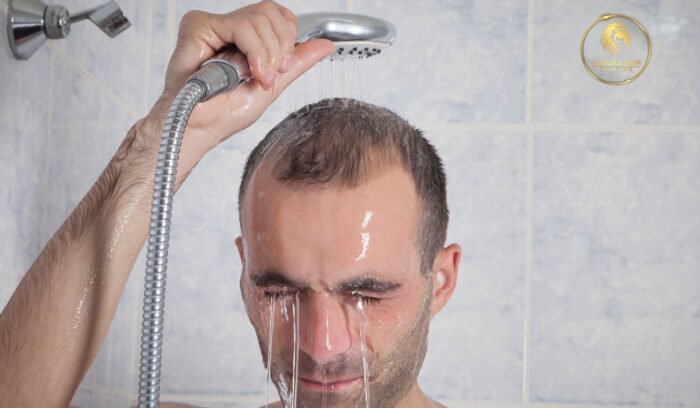 how to wash hair after hair transplant