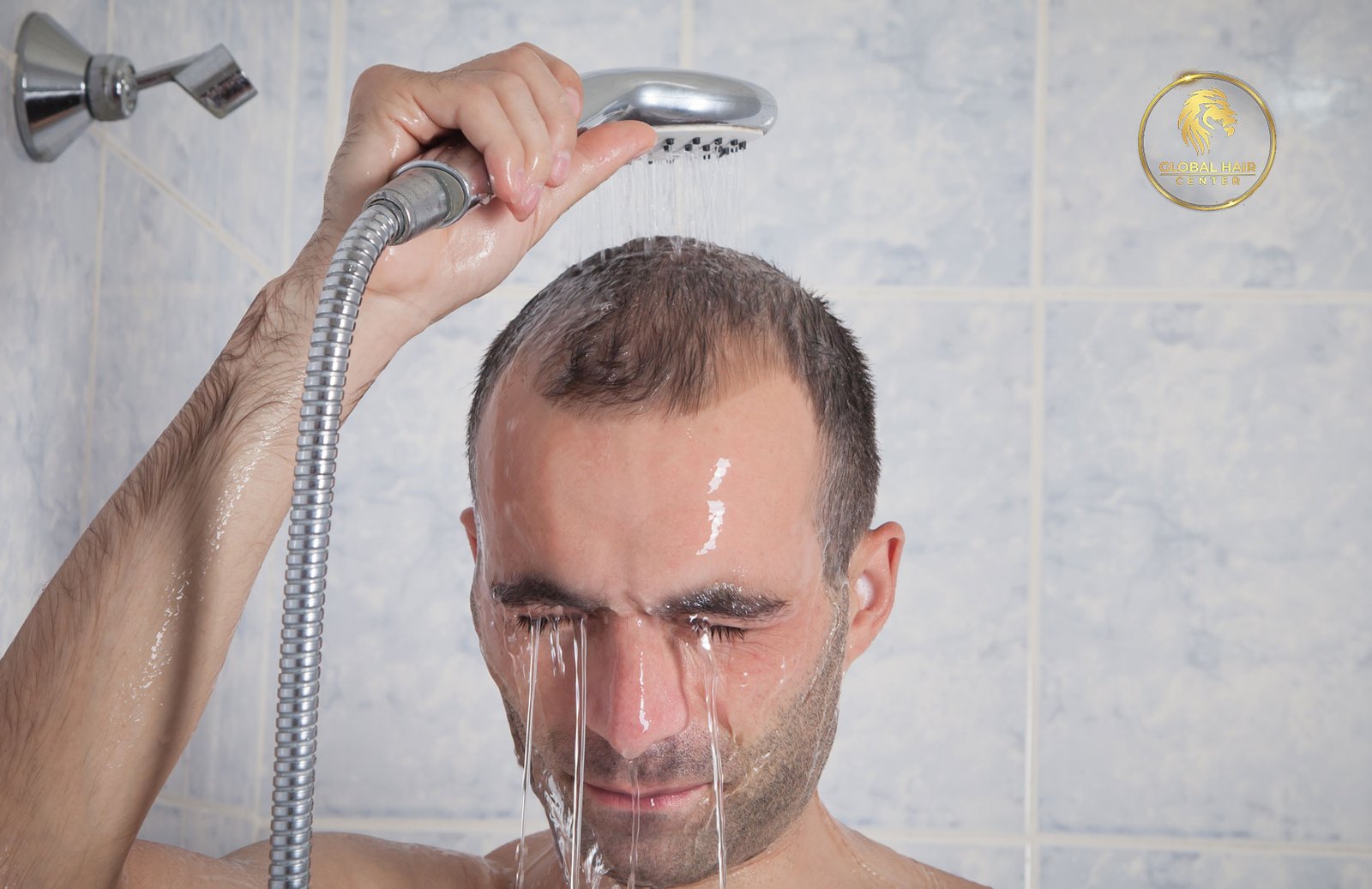 how to wash hair after hair transplant