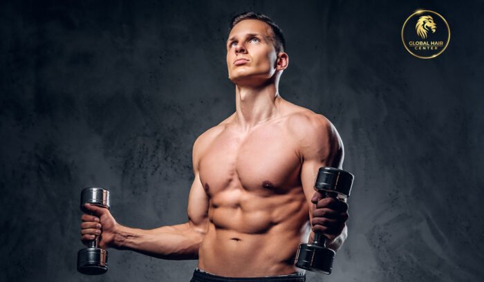 working out after hair transplant