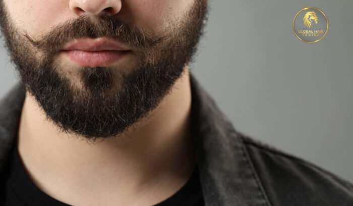 exploring the world of beard hair transplants