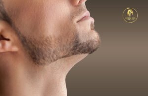 Facial Hair Restoration - Secrets of Beard Transplants for a Fuller Look

