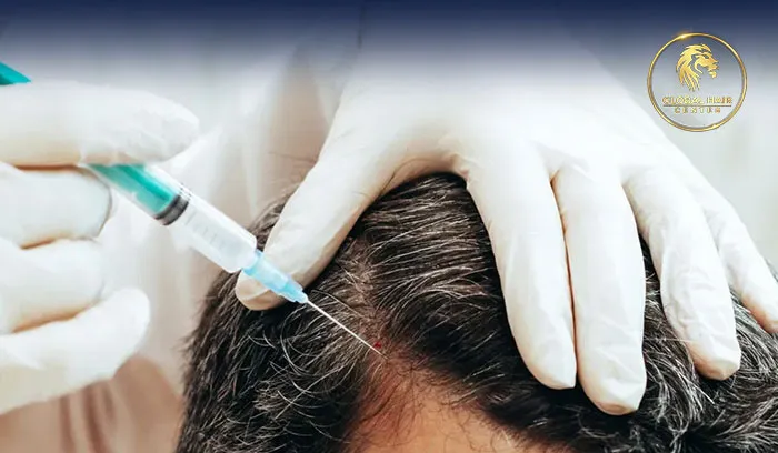 Natural Results For Hair Transplant in Dubai