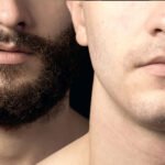 From Evaluation to Results: Understanding Mustache Hair Transplants