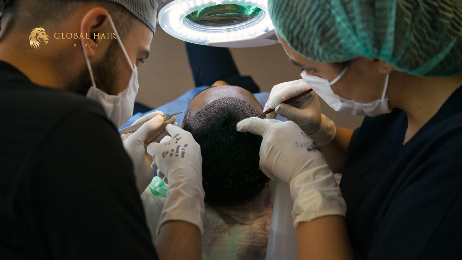 Natural Hair Restoration Dubai
