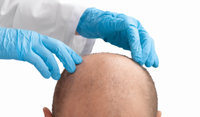 Advanced Hair Techniques Dubai