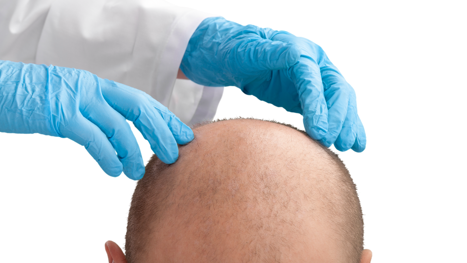 Advanced Hair Techniques Dubai