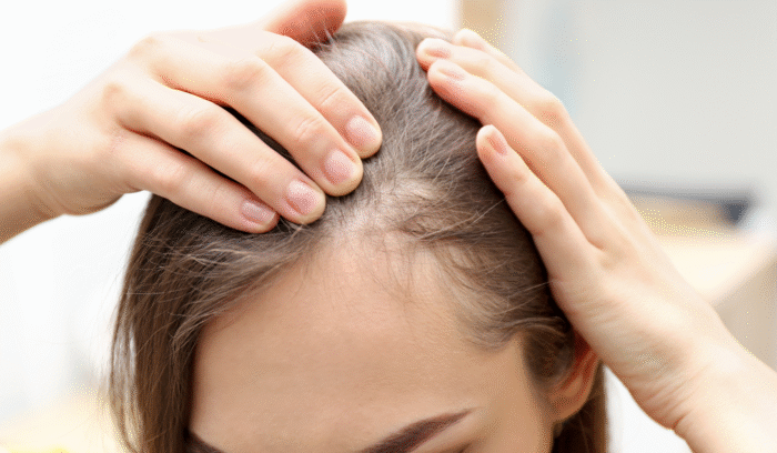 Female Hair Transplant Dubai
