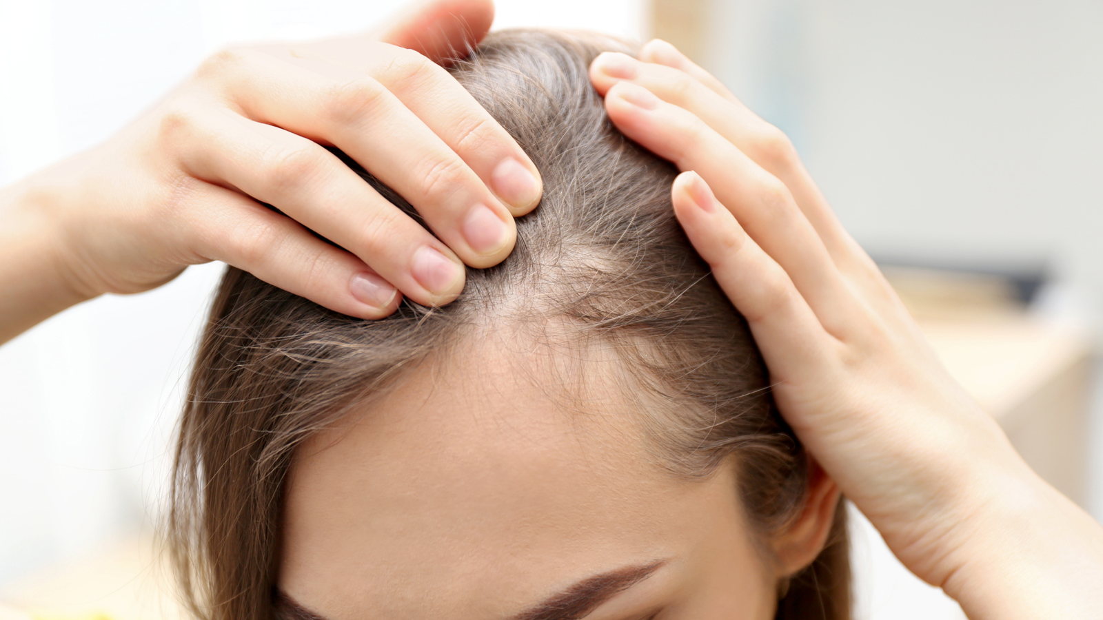 Female Hair Transplant Dubai