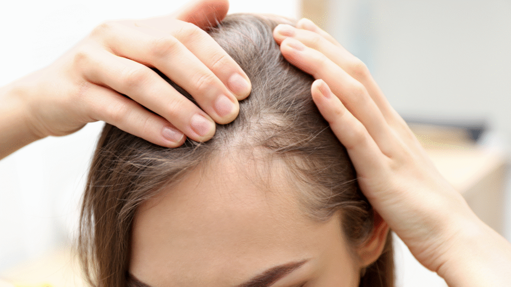 hair transplant in dubai