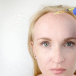 Women Hair Transplant Dubai