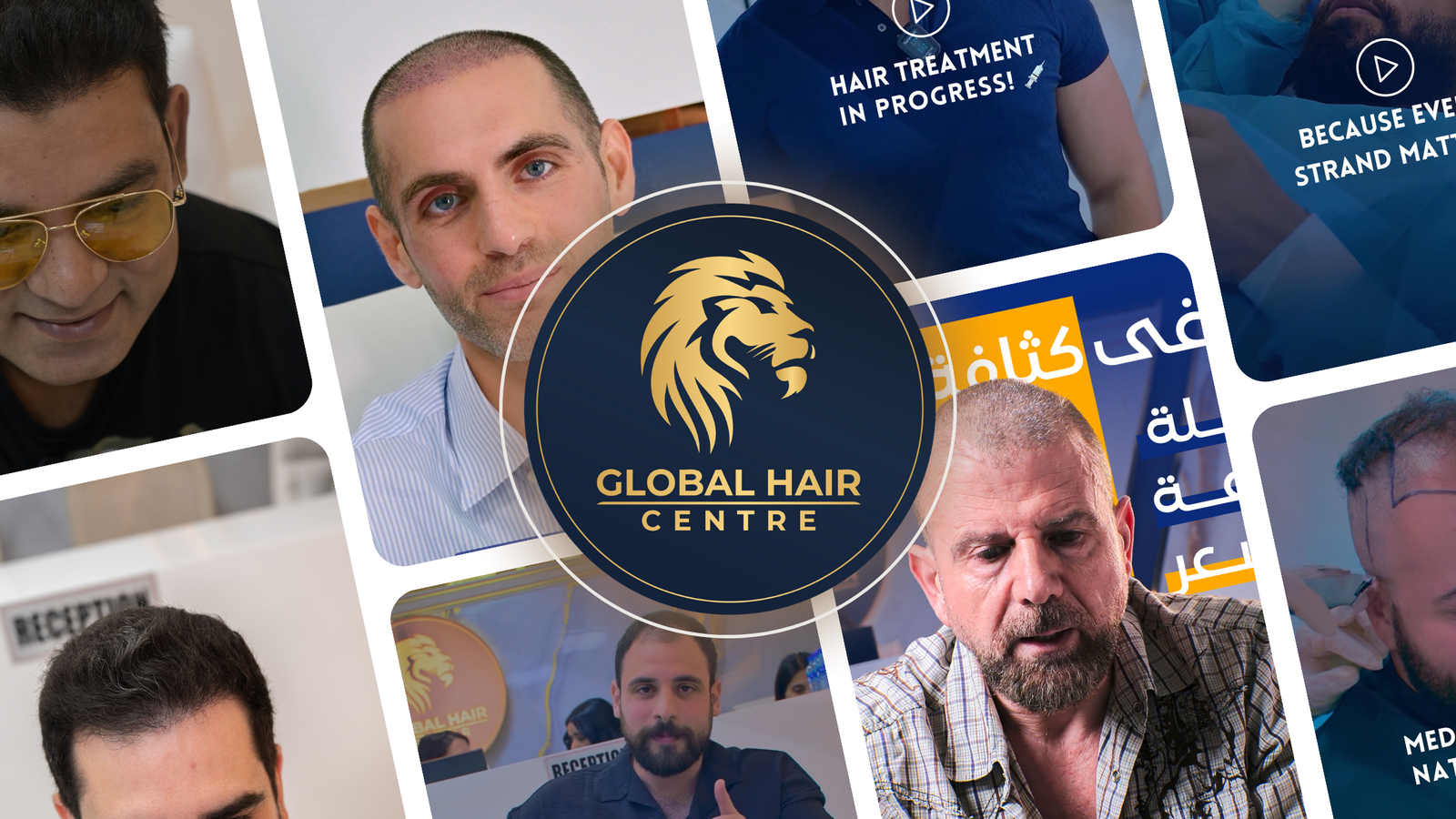 Leading Hair Restoration Dubai
