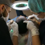 top 5 hair transplant clinic in Dubai