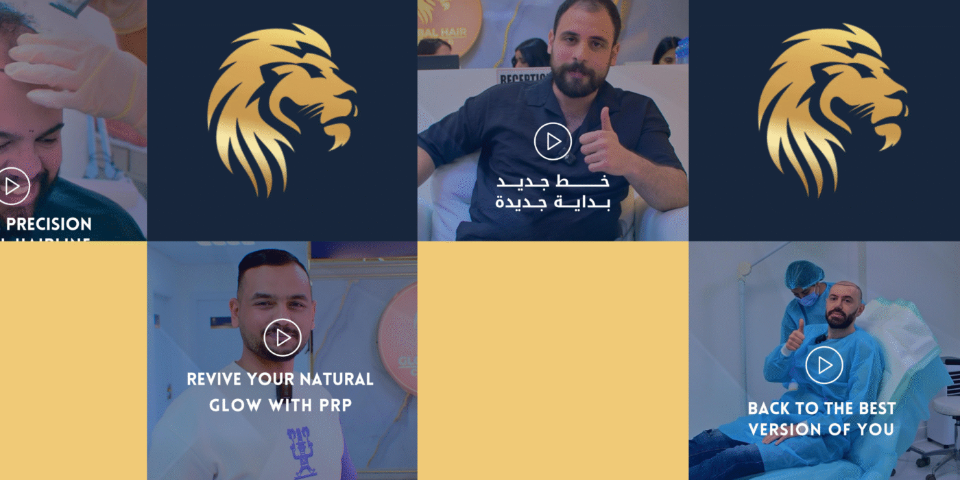 Global Hair Dubai Reviews