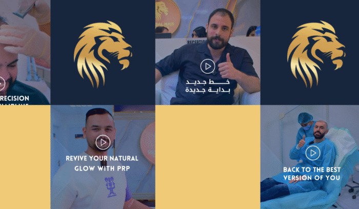 Global Hair Dubai Reviews