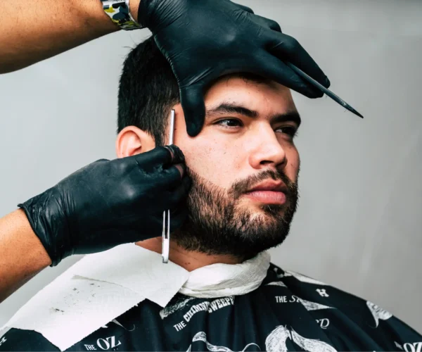 beard transplant in Dubai