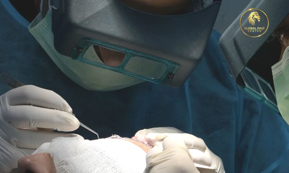 Choi Pen hair transplant Dubai