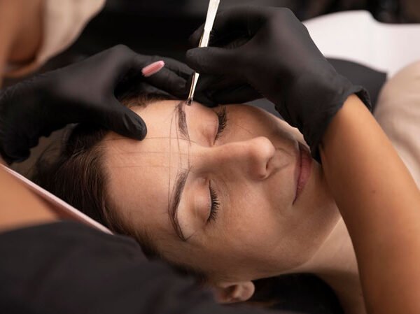 Eyebrow hair transplant