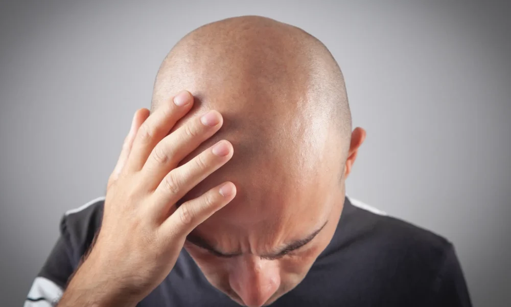 DHI hair transplant procedure in Dubai clinic
