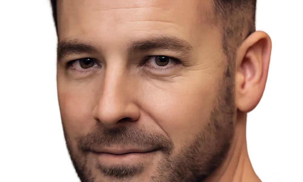 Best Hair Transplant Techniques in Dubai