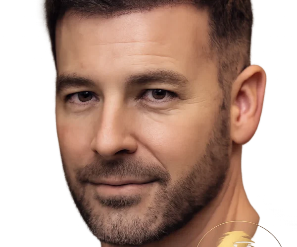 Best Hair Transplant Techniques in Dubai